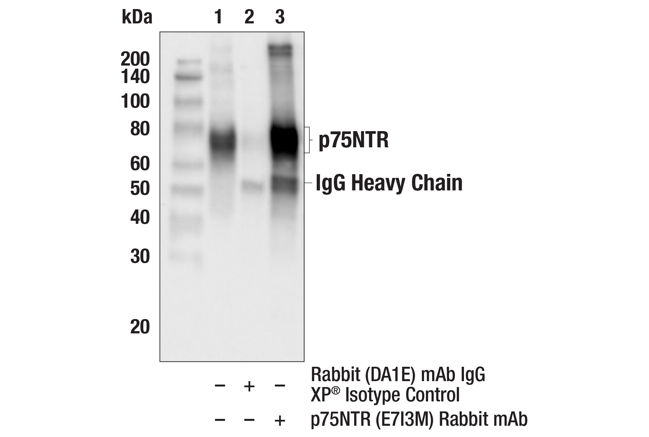 Immunoprecipitation Image 1: p75NTR (E7I3M) Rabbit mAb
