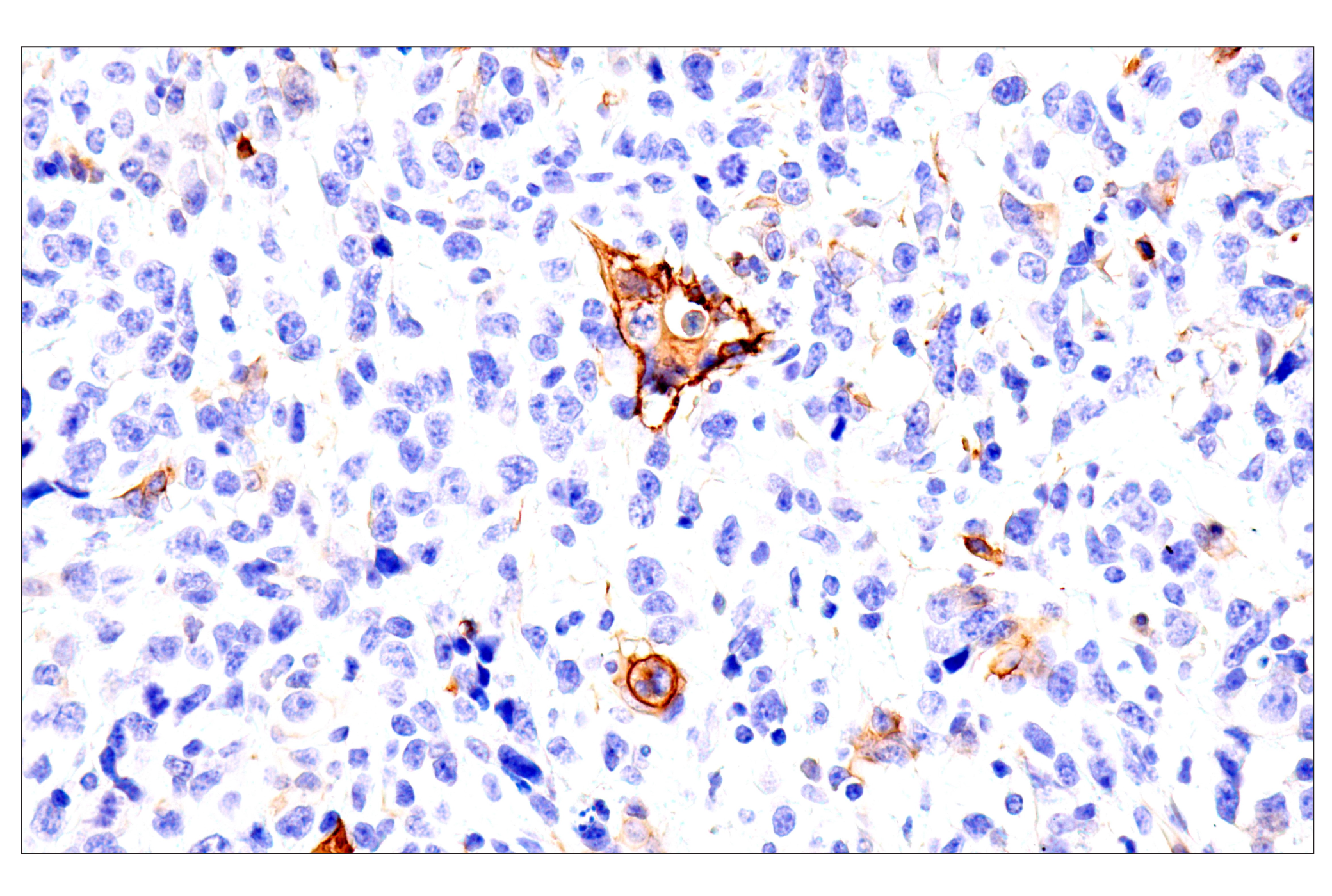 Immunohistochemistry Image 15: p75NTR (E7I3M) Rabbit mAb