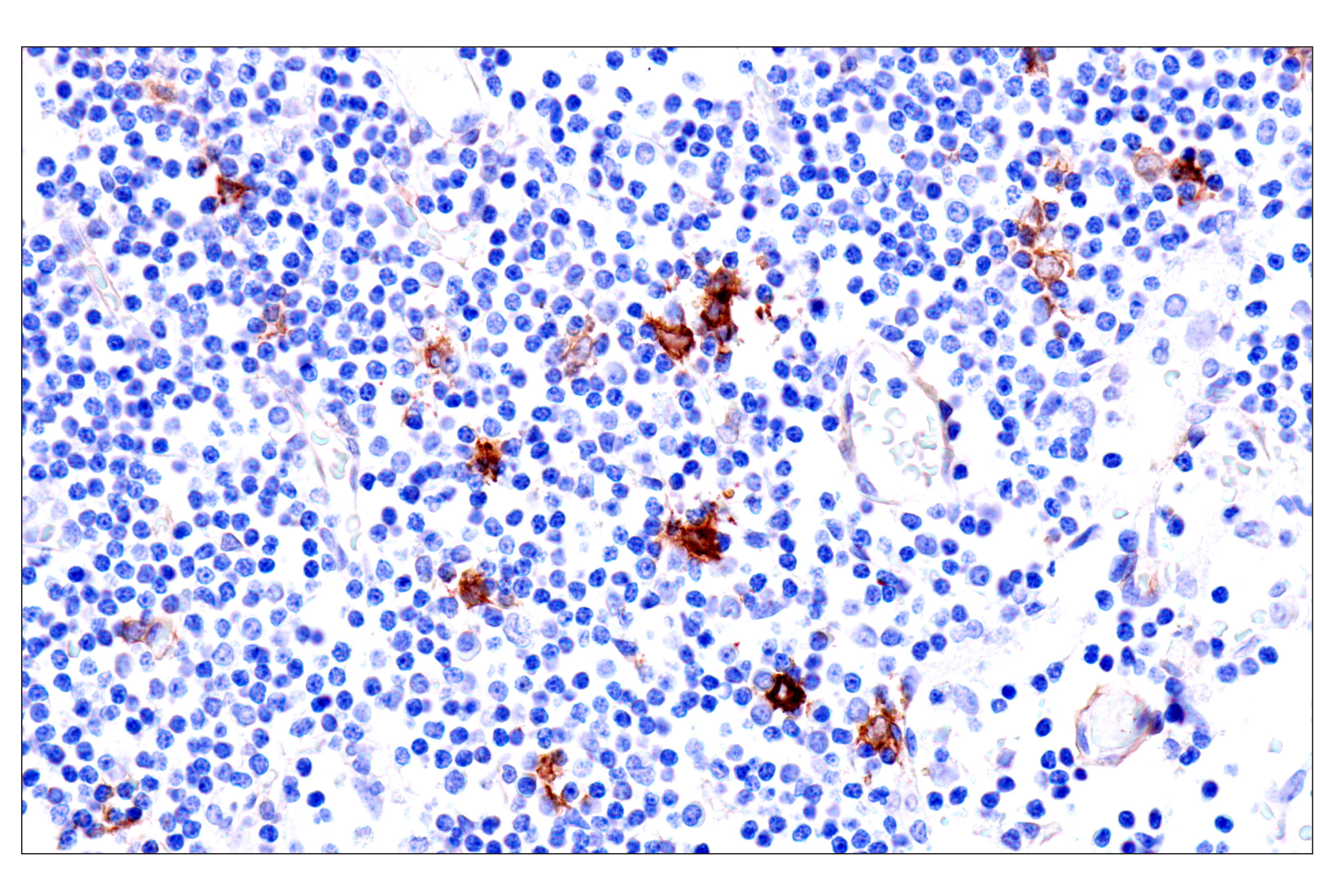 Immunohistochemistry Image 11: p75NTR (E7I3M) Rabbit mAb