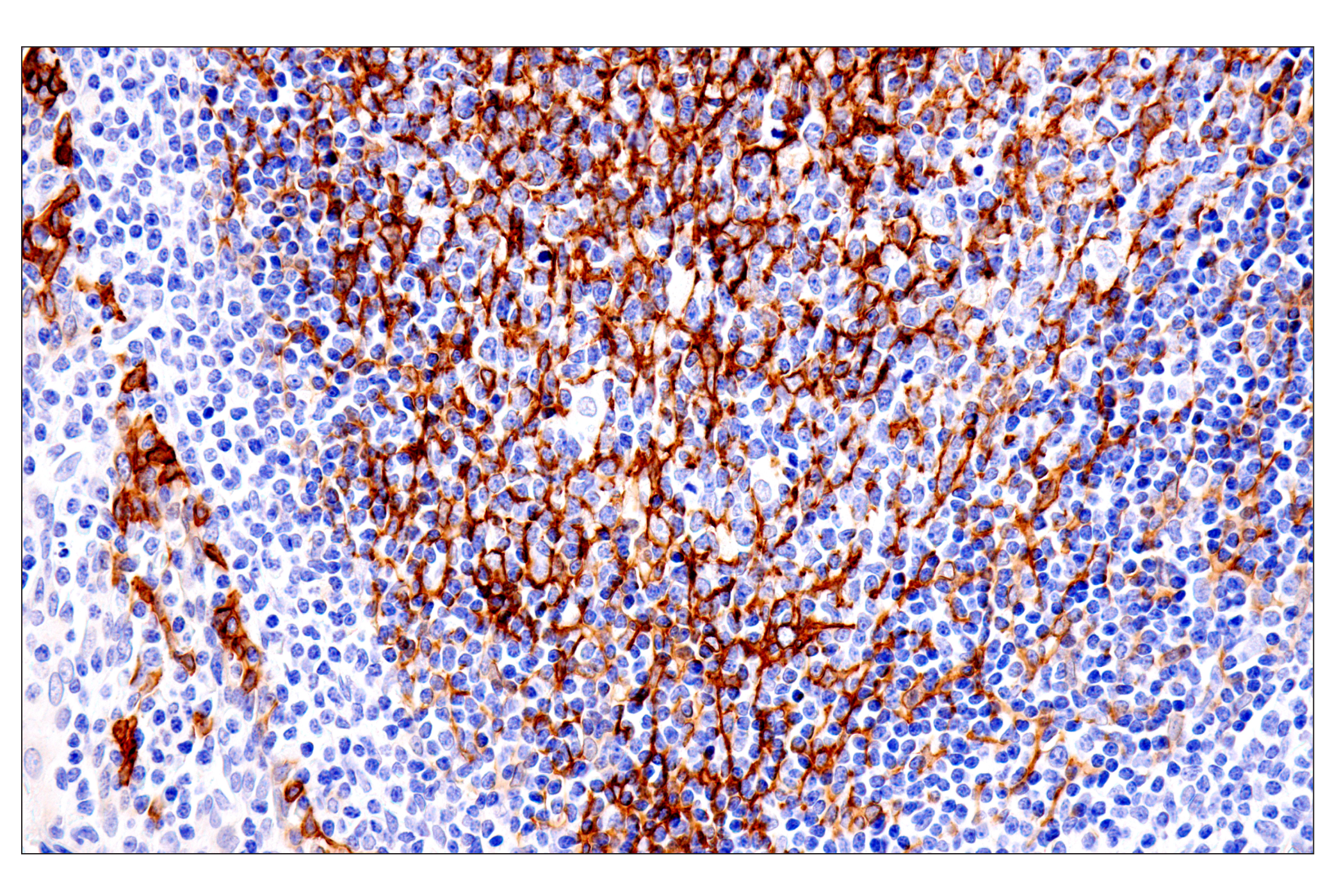 Immunohistochemistry Image 6: p75NTR (E7I3M) Rabbit mAb