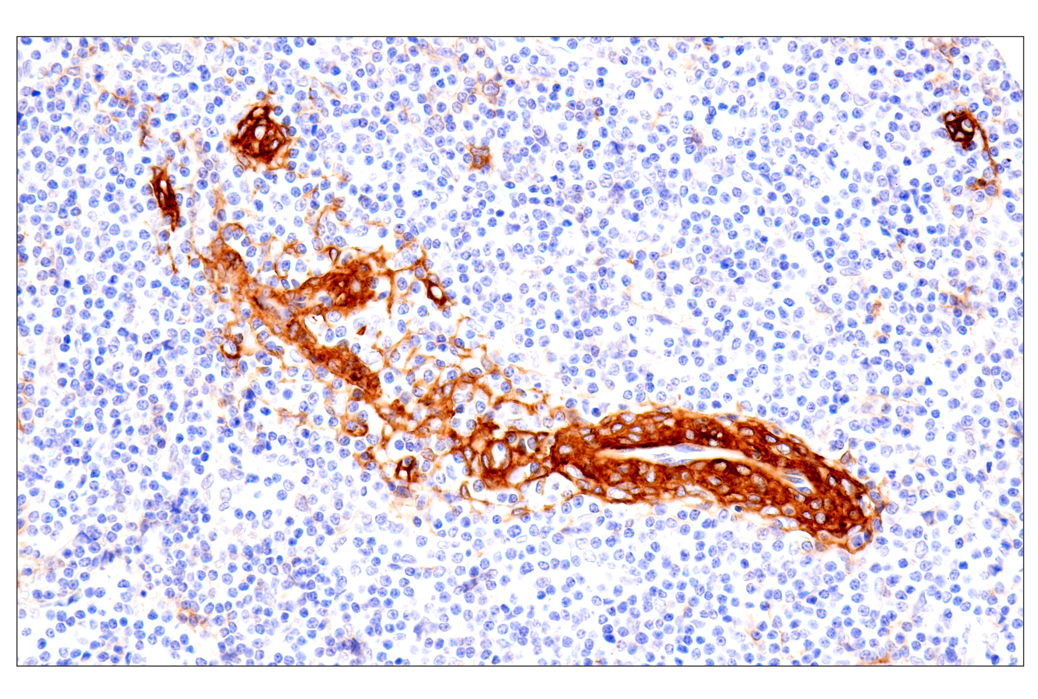 Immunohistochemistry Image 5: p75NTR (E7I3M) Rabbit mAb