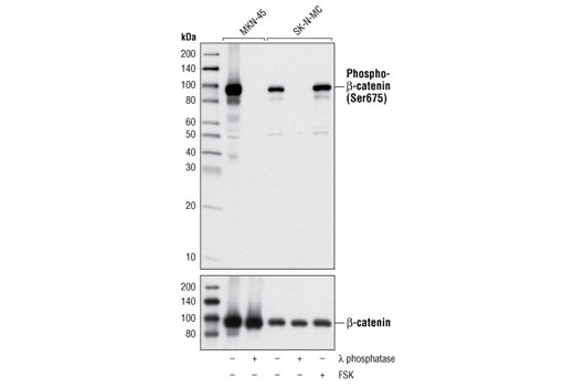  Image 9: β-Catenin Antibody Sampler Kit