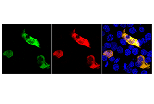 Immunofluorescence Image 1: LbCpf1/Cas12a (Strain ND2006) (E8B1W) Rabbit mAb