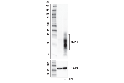  Image 8: Mouse Reactive Senescence Associated Secretory Phenotype (SASP) Antibody Sampler Kit