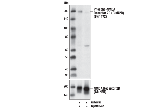 Western Blotting Image 1: Phospho-NMDA Receptor 2B (GluN2B) (Tyr1472) Antibody