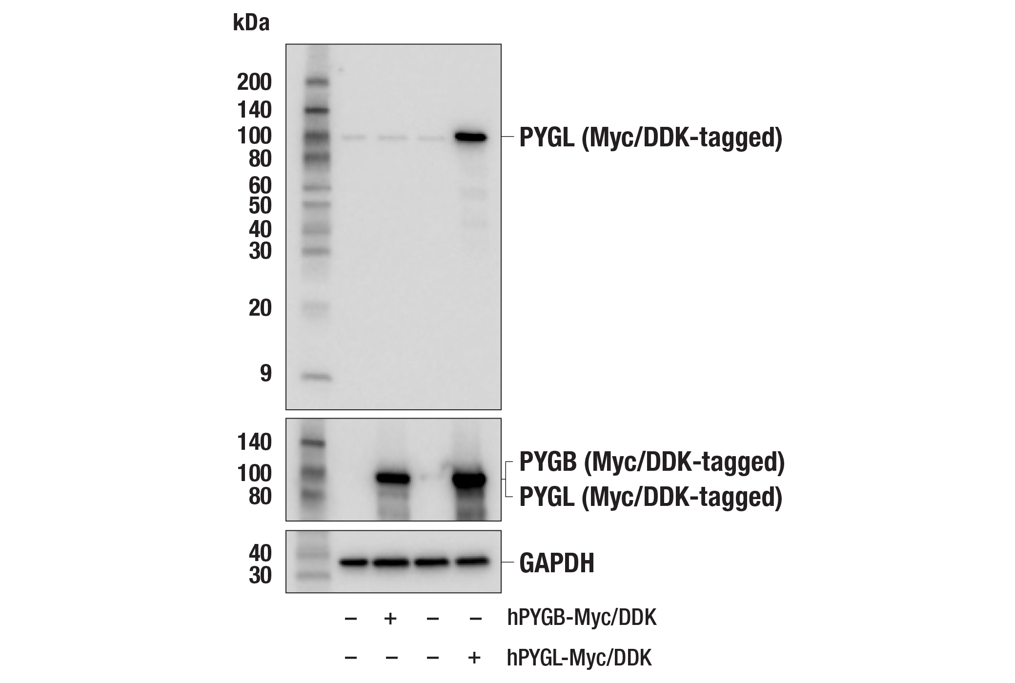 Pygl E4o1p Rabbit Mab Cell Signaling Technology