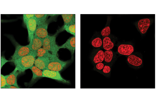 Immunofluorescence Image 2: 4E-BP1 (53H11) Rabbit mAb (BSA and Azide Free)