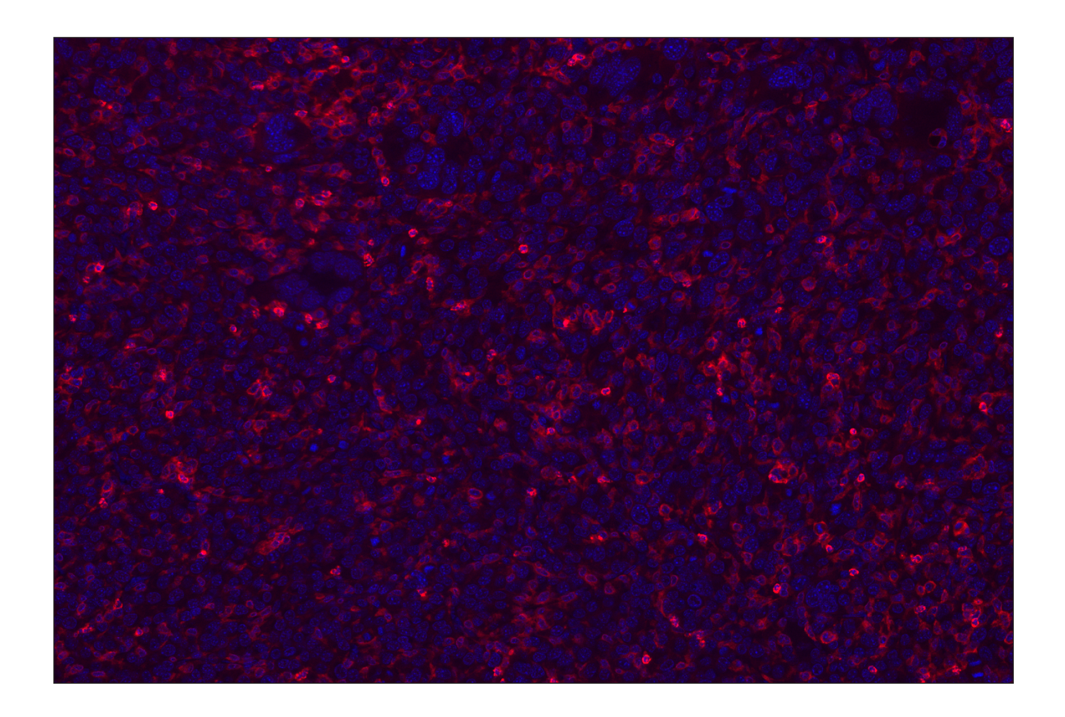 Immunohistochemistry Image 2: CD11b/ITGAM (E4K8C) Rabbit mAb (Alexa Fluor® 647 Conjugate)