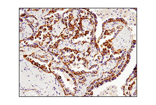  Image 25: Mitochondrial Dynamics Antibody Sampler Kit