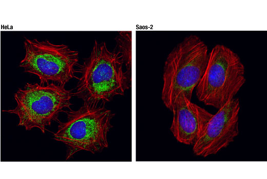  Image 33: Mitochondrial Dynamics Antibody Sampler Kit