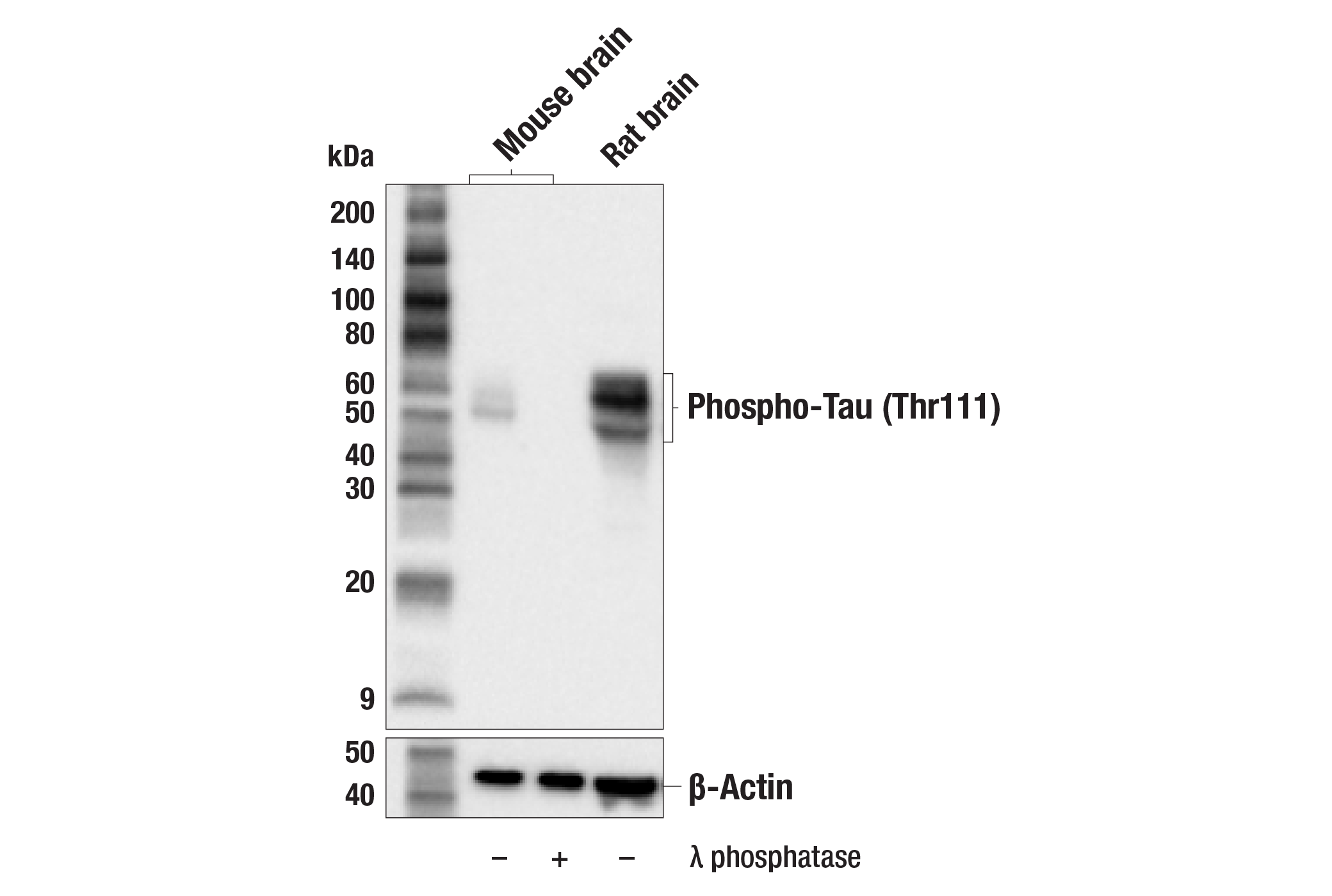 Western Blotting Image 1: Phospho-Tau (Thr111) Antibody