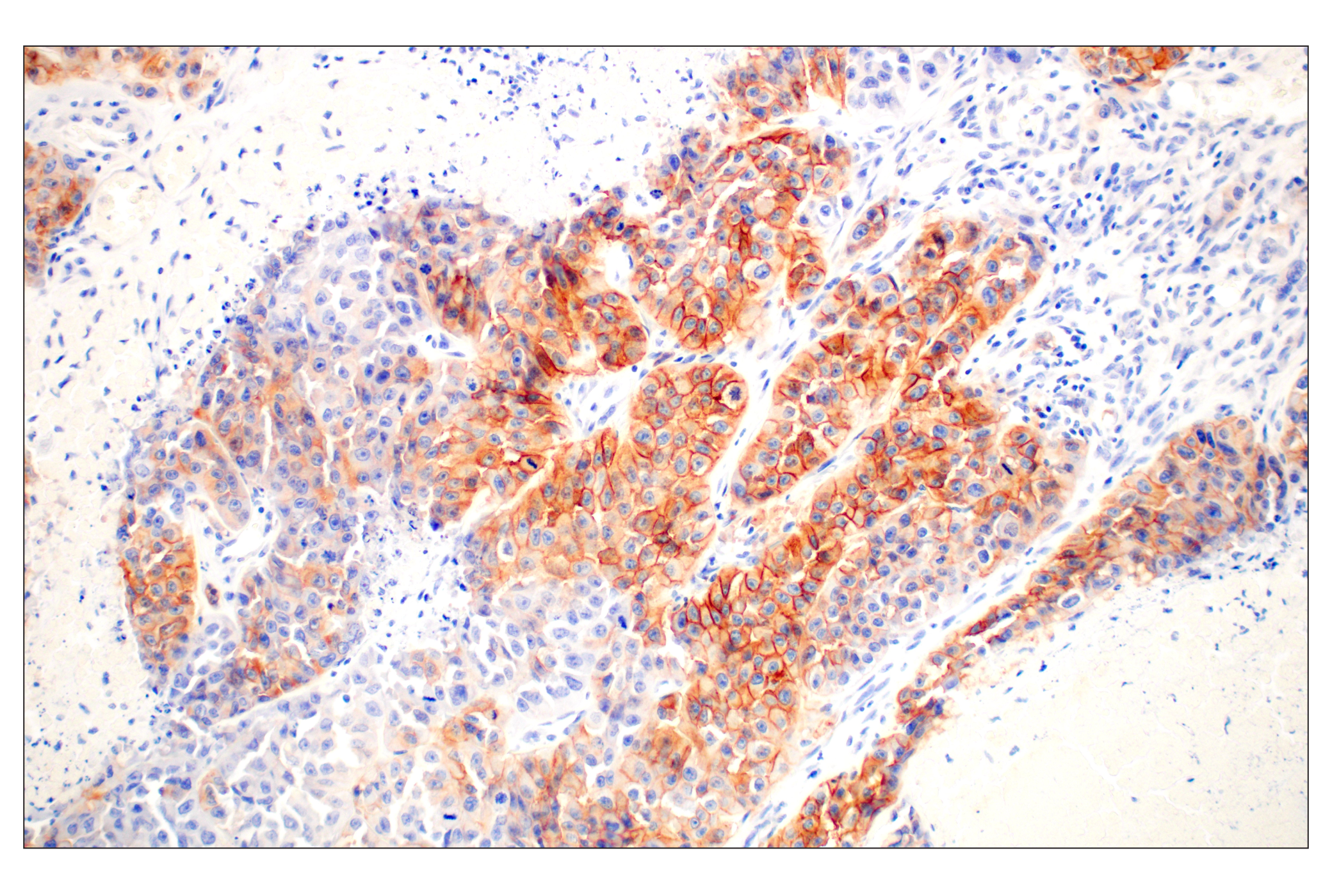  Image 37: Lung Cancer RTK Antibody Sampler Kit