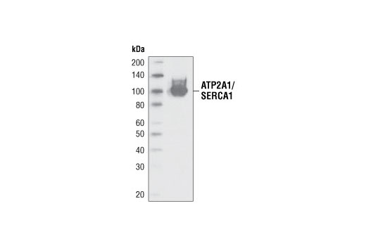 Western Blotting Image 1: ATP2A1/SERCA1 (A988) Antibody