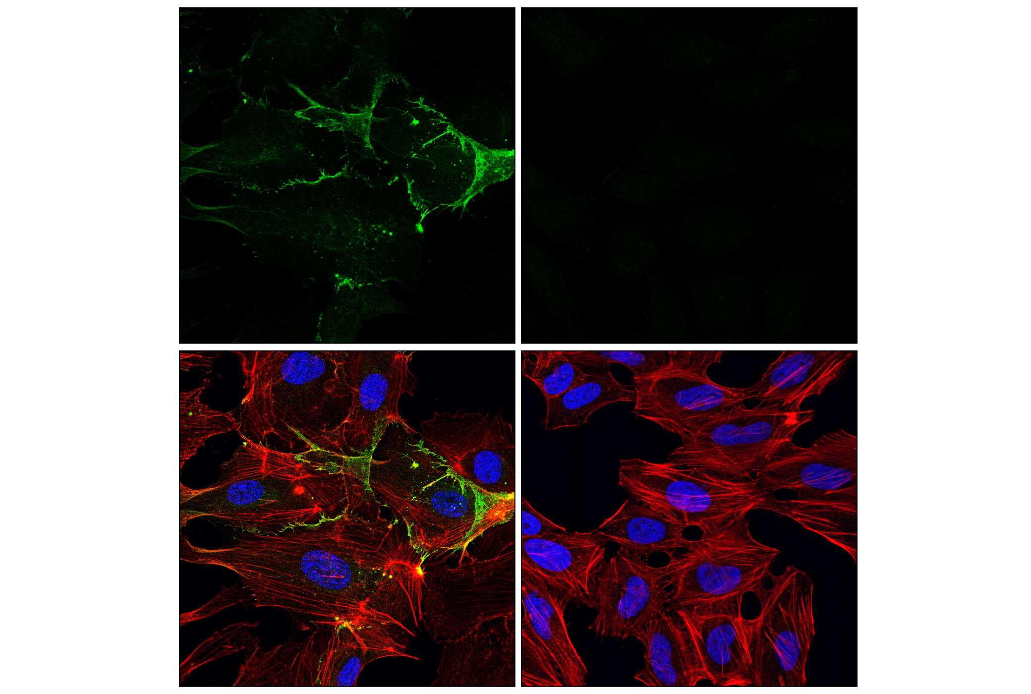 Immunofluorescence Image 1: CD31 (PECAM-1) (89C2) Mouse mAb (Alexa Fluor® 488 Conjugate)