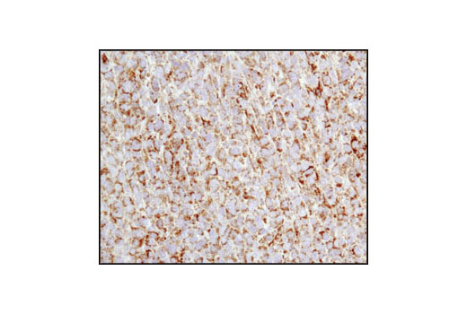  Image 22: Mitochondrial Marker Antibody Sampler Kit
