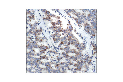  Image 32: Mitochondrial Marker Antibody Sampler Kit