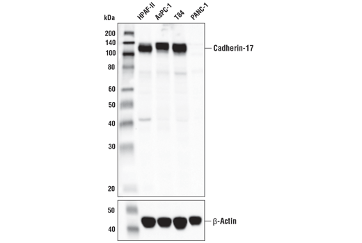 Western Blotting Image 1: Cadherin-17 Antibody
