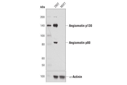 Western Blotting Image 1: Angiomotin (D2O4H) Rabbit mAb