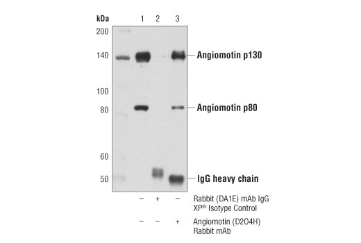 Immunoprecipitation Image 1: Angiomotin (D2O4H) Rabbit mAb
