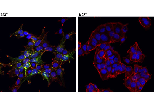 Immunofluorescence Image 1: Angiomotin (D2O4H) Rabbit mAb