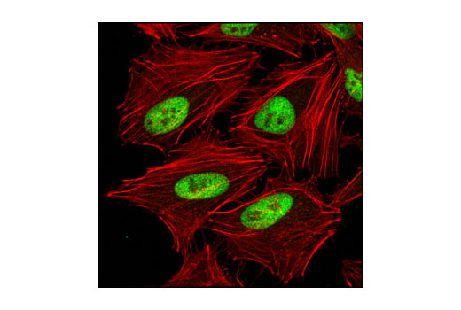 Immunofluorescence Image 1: RAD21 (D213) Antibody