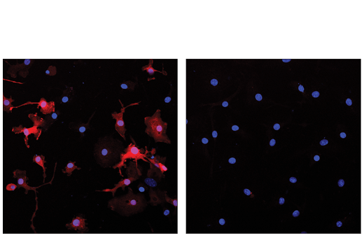 Immunofluorescence Image 2: Arginase-1 (D4E3M™) XP® Rabbit mAb (Alexa Fluor® 647 Conjugate)
