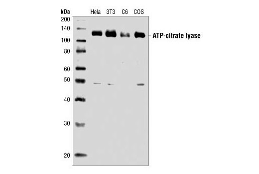 Western Blotting Image 1: ATP-Citrate Lyase Antibody