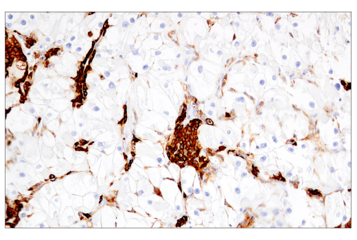 Immunohistochemistry Image 3: CD38 (E7Z8C) XP® Rabbit mAb (BSA and Azide Free)