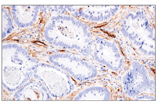 Immunohistochemistry Image 3: CD141/Thrombomodulin (E7Y9P) XP® Rabbit mAb