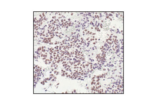  Image 23: HSP/Chaperone Antibody Sampler Kit