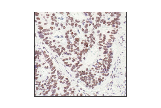  Image 35: HSP/Chaperone Antibody Sampler Kit