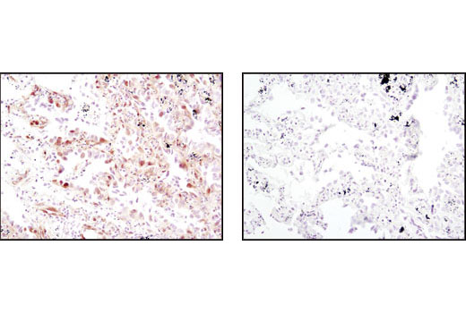  Image 36: Cannabinoid Receptor 1 Downstream Signaling Antibody Sampler Kit