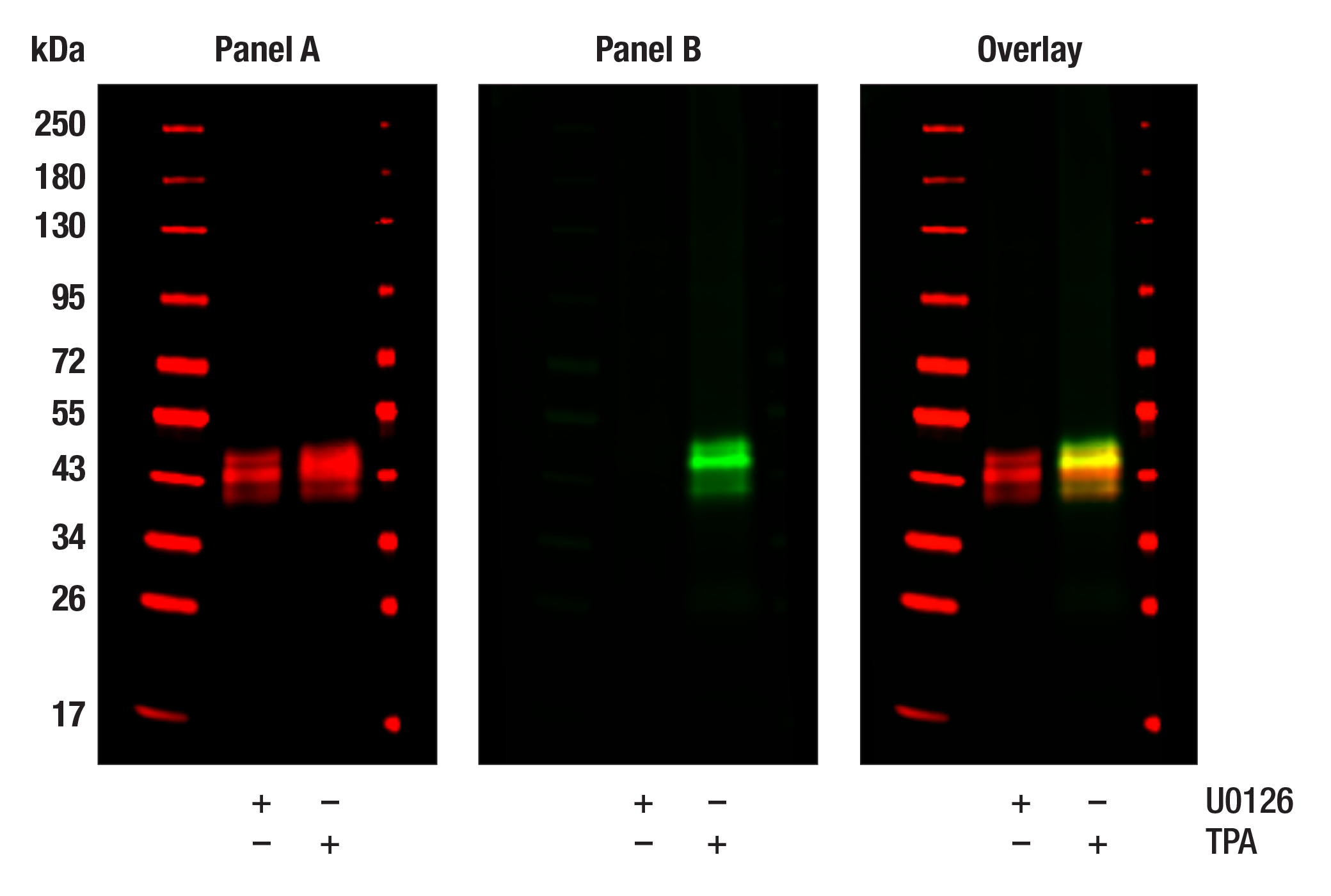 undefined Image 11: Cannabinoid Receptor 1 Downstream Signaling Antibody Sampler Kit