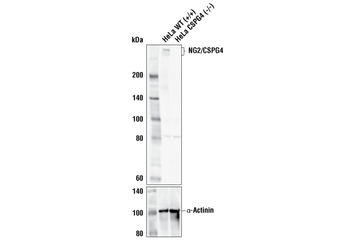  Image 24: Oligodendrocyte Marker Antibody Sampler Kit