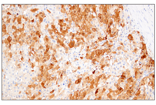 Immunohistochemistry Image 2: Arginase-1 (E4U1I) Mouse mAb