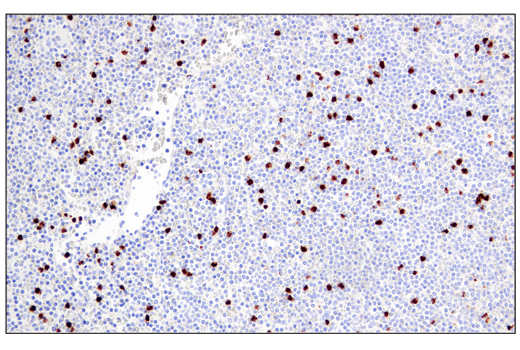 Immunohistochemistry Image 3: Arginase-1 (E4U1I) Mouse mAb