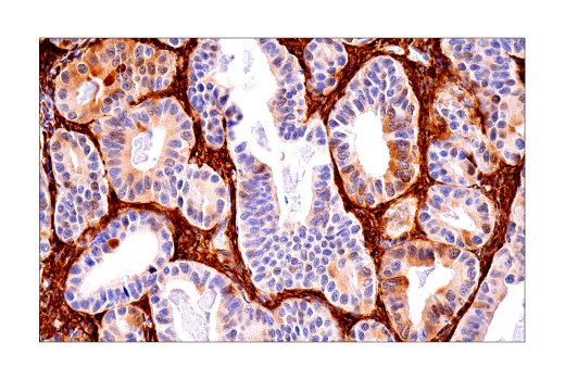 Immunohistochemistry Image 3: FTH1 (D1D4) Rabbit mAb