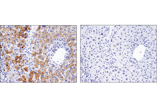 Immunohistochemistry Image 4: BNIP3 (D7U1T) Rabbit mAb