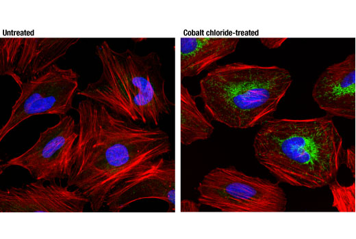 Immunofluorescence Image 1: BNIP3 (D7U1T) Rabbit mAb