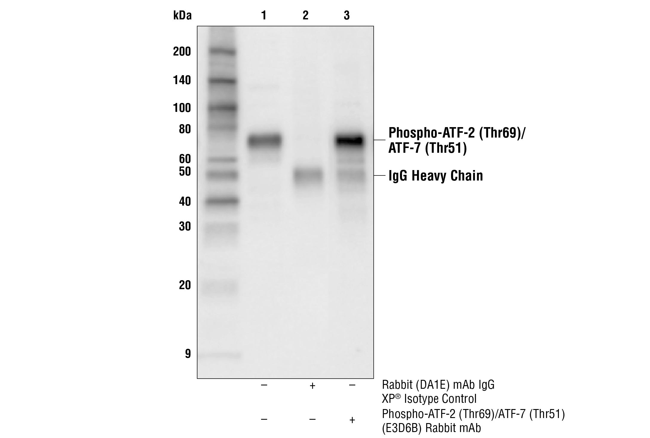 Immunoprecipitation Image 1: Phospho-ATF-2 (Thr69)/ATF-7 (Thr51) (E3D6B) Rabbit mAb