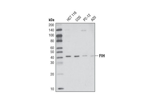  Image 4: Hypoxia Pathway Antibody Sampler Kit