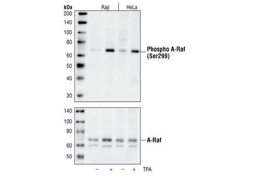 Western Blotting Image 1: Phospho-A-Raf (Ser299) Antibody