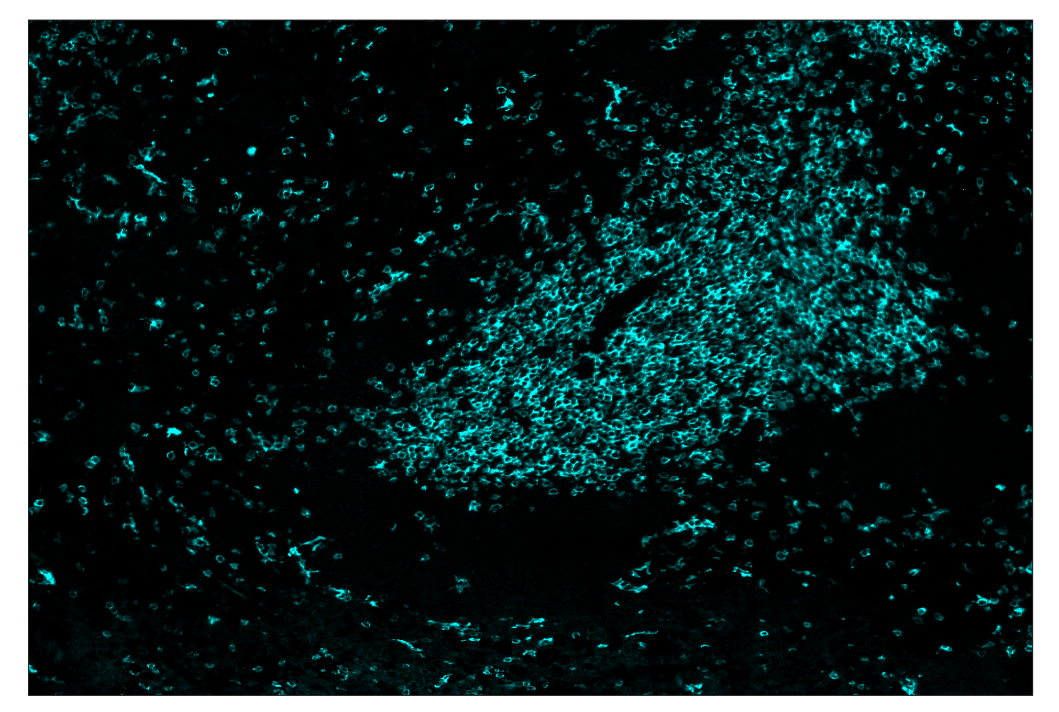 Immunohistochemistry Image 5: CD8α (D4W2Z) & CO-0040-594 SignalStar™ Oligo-Antibody Pair