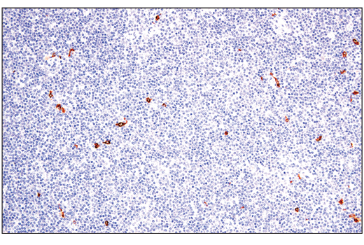 Immunohistochemistry Image 1: XCR1 (D2F8T) Rabbit mAb
