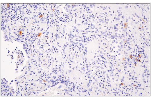Immunohistochemistry Image 3: XCR1 (D2F8T) Rabbit mAb