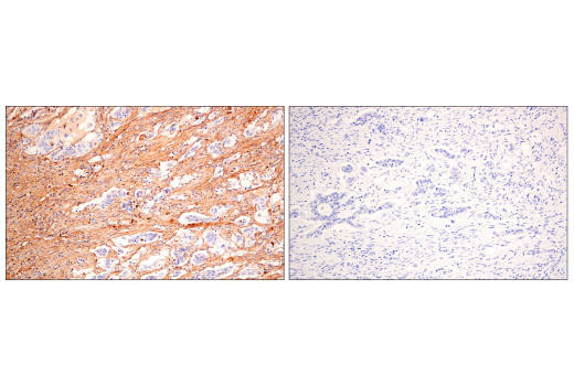 Immunohistochemistry Image 3: Fibronectin/FN1 (E5H6X) Rabbit mAb (BSA and Azide Free)