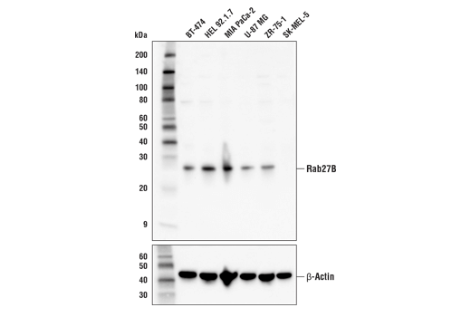 Western Blotting Image 1: Rab27B Antibody