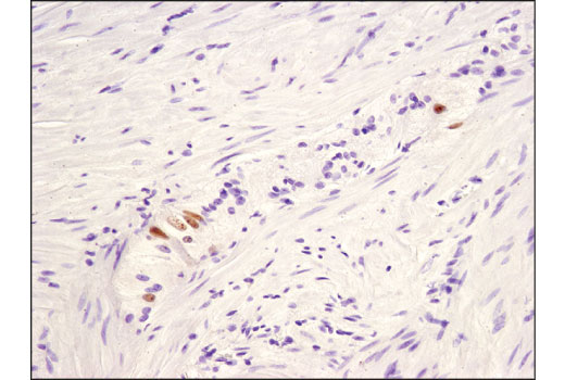 Immunohistochemistry Image 2: CHD5 (D2F9Q) Rabbit mAb