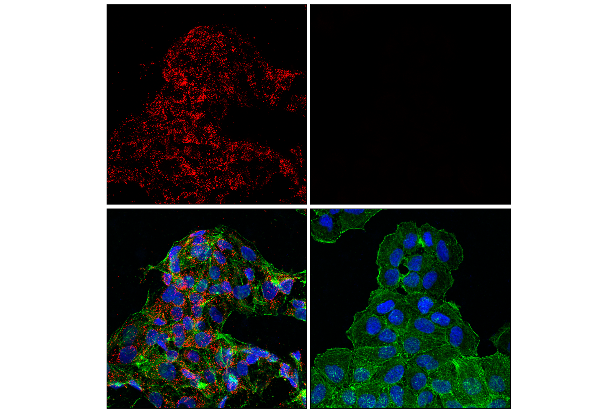 Immunofluorescence Image 1: Catalase (D4P7B) XP® Rabbit mAb (Alexa Fluor® 647 Conjugate)