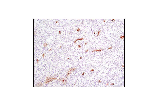 Immunohistochemistry Image 2: Caveolin-1 (D46G3) XP® Rabbit mAb (BSA and Azide Free)